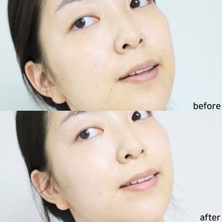 Nước Hoa Hồng Eucerin Dermato Clean Sensitive 200ml