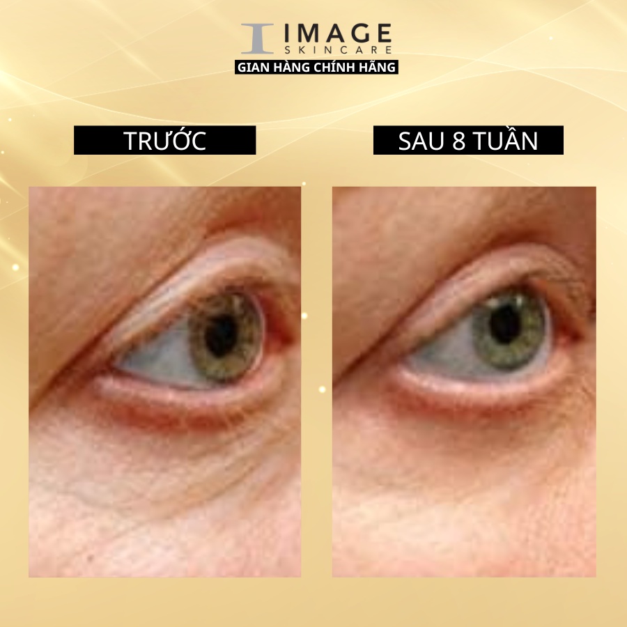 Kem giảm nhăn vùng mắt Image Skincare The Max Stem Cell Eye Creme 15ml