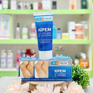 Kem Dưỡng Nứt Gót Chân Nga Kpem