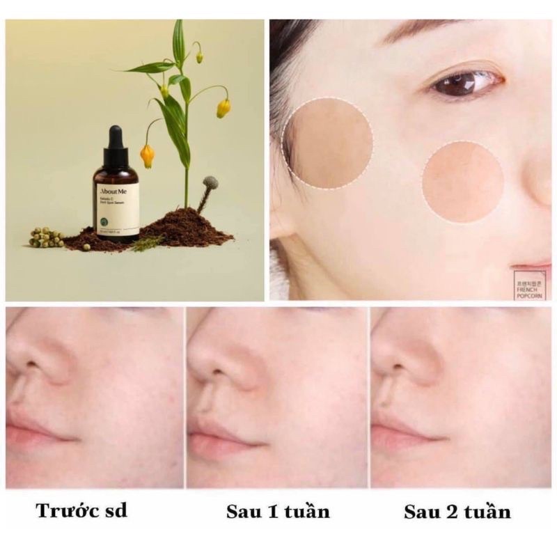 ❤️ SERUM VITAMIN C NGUYÊN CHẤT KAKADU của ABOUT ME
