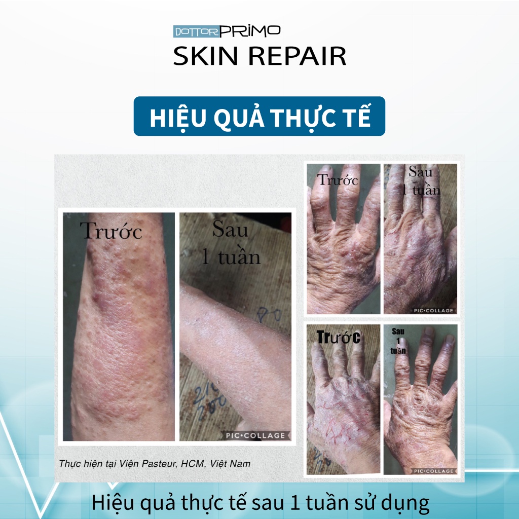 Kem Viêm Da Cơ Địa, Chàm Da, Eczema, Da Nứt Nẻ DottorPrimo Skin Repair (Tuýp 20-50ml)