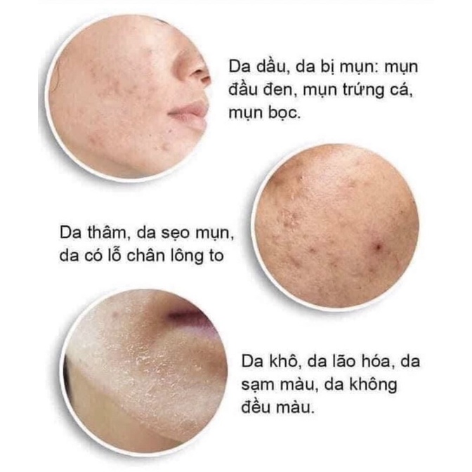 Gel bôi ngoài da dành cho da mụn ẩn thâm mụn sần sùi