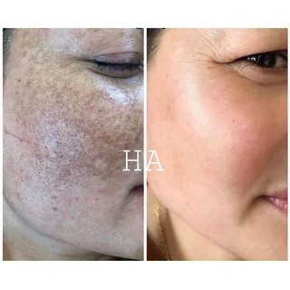 OSAKURA SỐ 2 CHÍNH HÃNG