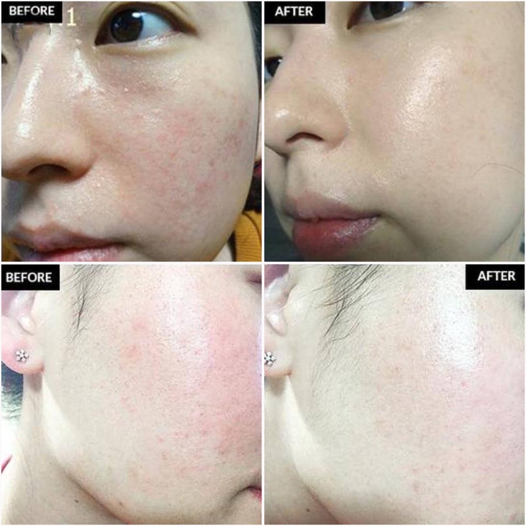 Kem Dưỡng Cấp Ẩm, Làm Dịu Da Klairs Midnight Blue Calming Cream