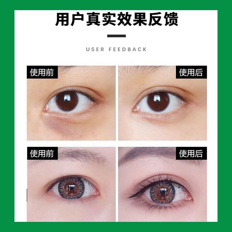 Tinh Chất Thảo Mộc Tạo Mắt Hai Mí Tự Nhiên 11 / 13xx