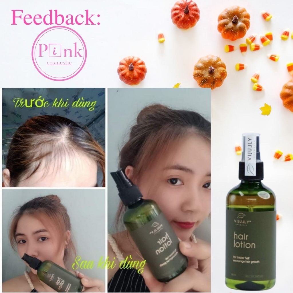 Tinh Dầu Bưởi VIJULY Mới Giảm Rụng Tóc - Kích Thích Mọc Tóc 150ml - PinkStore