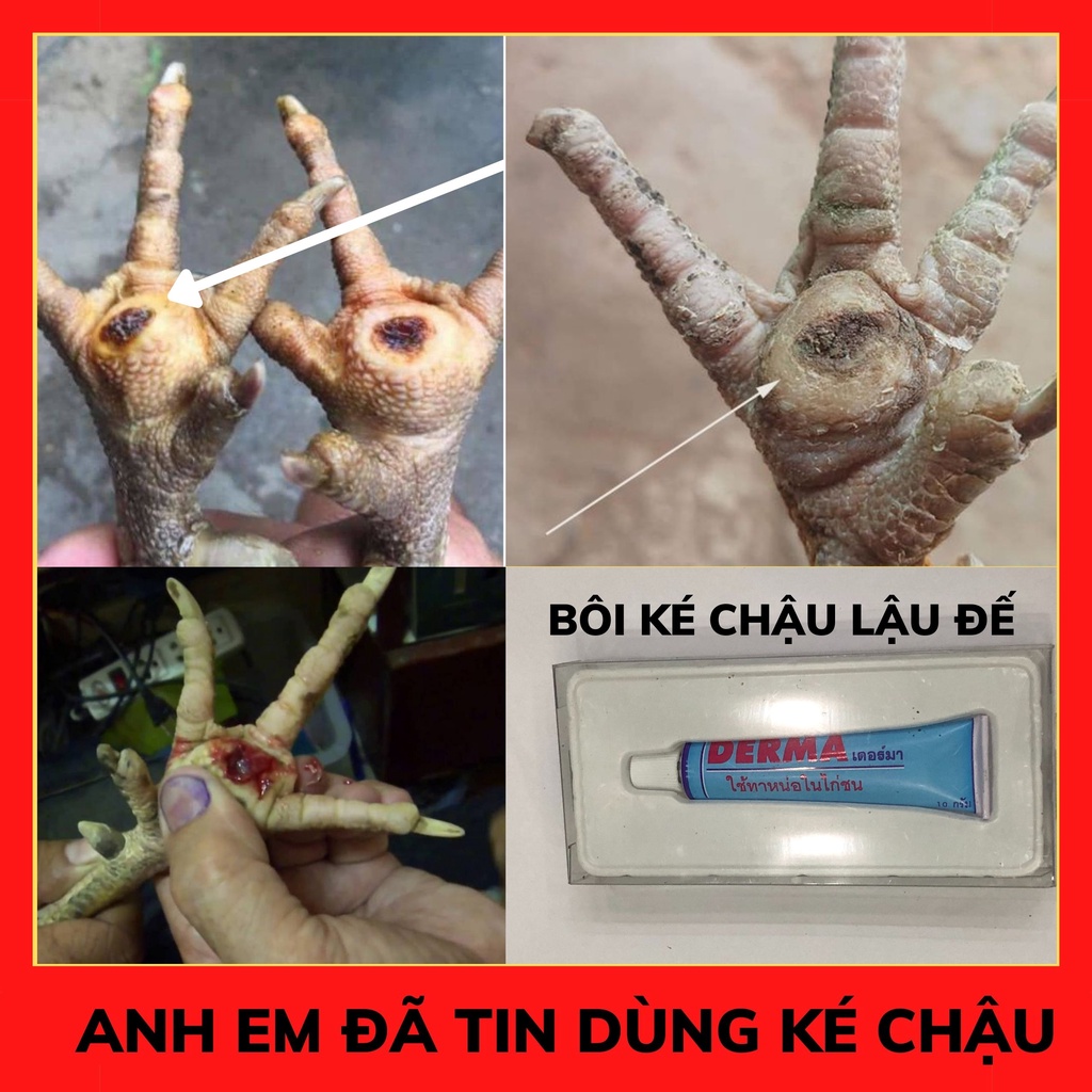 LẬU ĐẾ, KÉ CHẬU CHO GÀ cách chữ a lậu đế gà chọi TUÝP DERMA