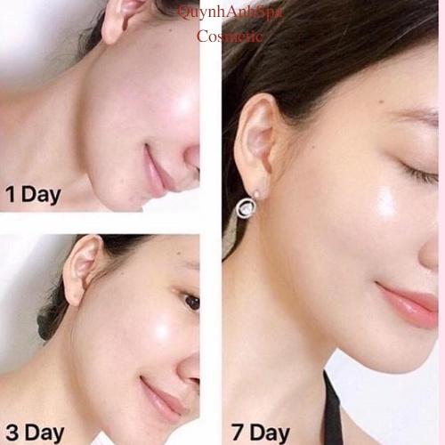 Kem dưỡng da ngày và đêm Olay Total Effects 7 in 1 Kem dưỡng ẩm chống lão hóa quynhanhspa20 50 ml | BigBuy360 - bigbuy360.vn