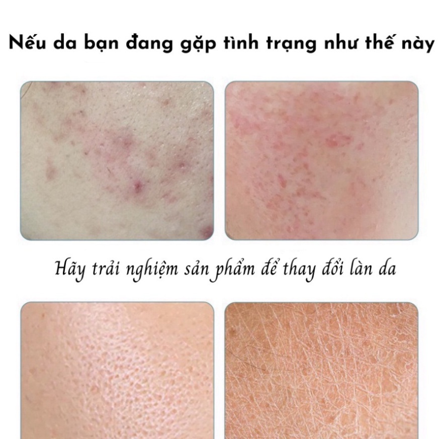 Mặt nạ giấy HA Images Bioaqua dưỡng trắng da mụn cấp ẩm thải độc HAI3 DANA