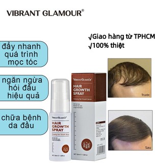 [Hàng Nhập] VIBRANT GLAMOUR Tinh Chất Kích Thích Mọc Tóc Giảm Gãy Rụng Chống Hói 30ml