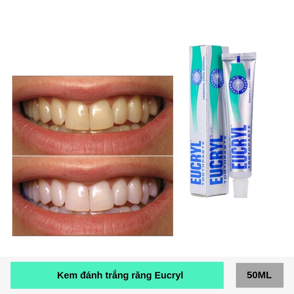 Combo Kem đánh răng Eucryl 62g + Bột tẩy trắng răng Eucryl 50g