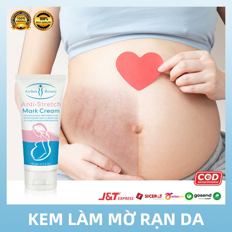 【Mua 3 Tặng 1】Aichun Beauty Kem làm mờ rạn da, kem tái tạo da hiệu quả cho bà bầu Anti-stretch Marks Cream - mờ sẹo, giảm nhăn hiệu quả