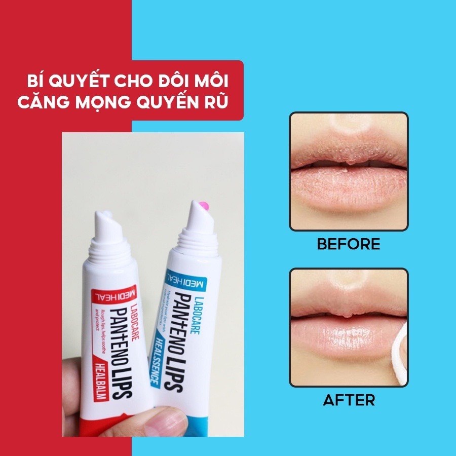 Son Dưỡng Môi Ban Ngày/ Đêm Mediheal, Làm Mờ Thâm Môi, Mềm Môi - Mediheal Labocare Panteno Lips