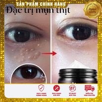 Kem mụn thịt quanh mắt (tuanboutique)