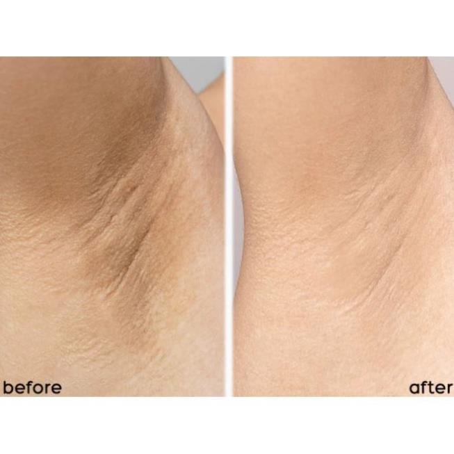 Lăn nách glutathione, Lăn khử mùi Glutathione mờ thâm dưỡng trắng 60ml