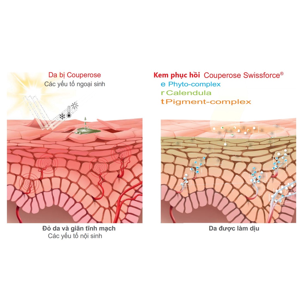 Kem Phục Hồi Kích Ứng Da Couperose Swissforce