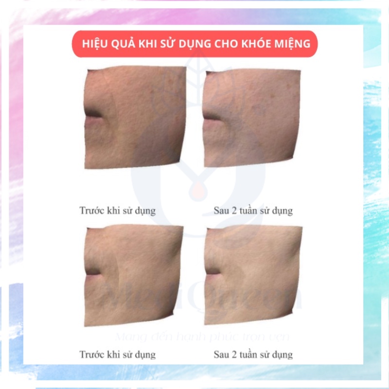 Gel Nâng Cơ Xóa Nhăn CareCella Facial line up lifting gel 16 gói x 9ml