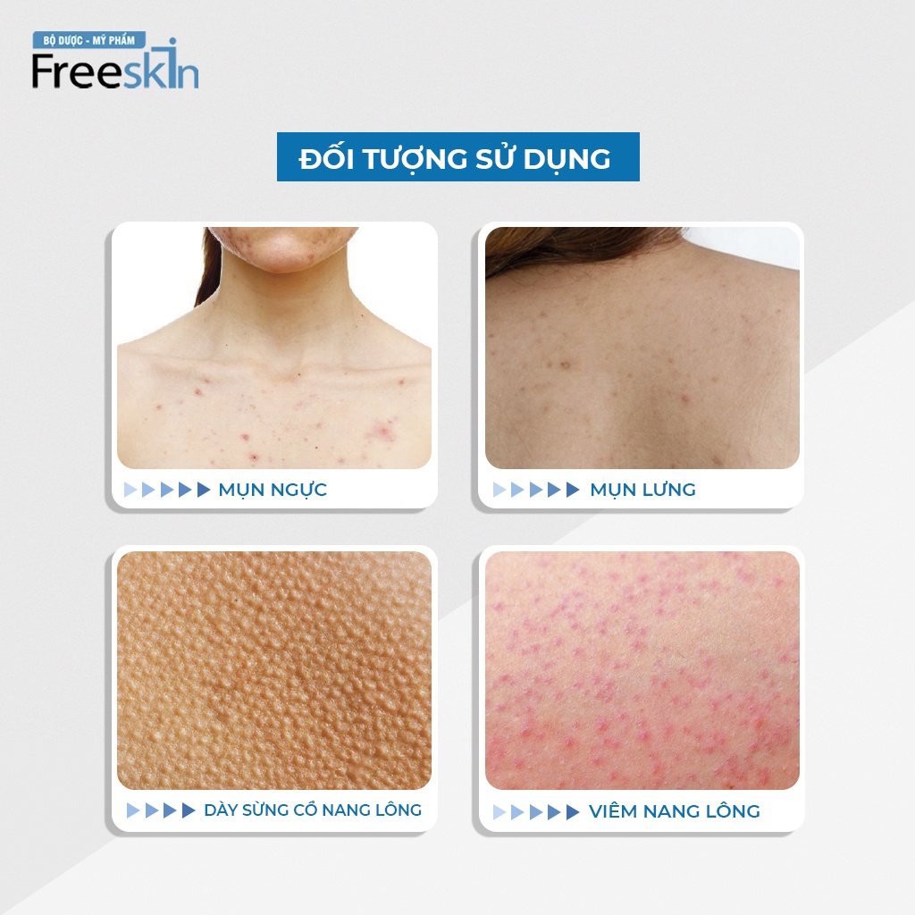 Gel tắm ngừa mụn Novocare - Freeskin ngăn ngừa viêm nang lông loại bỏ yếu tố gây ra mụn viêm, dùng cho da nhạy cảm 250ml