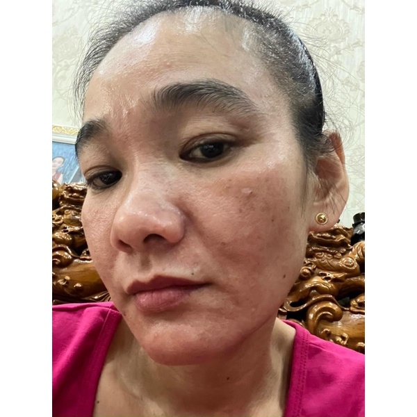Mẫu Mới COMBO CỐT NÁM ĐÔNG Y THANH NHI NICOS