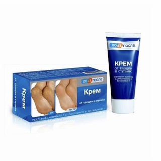 Kem giảm nứt gót chân Kpem Apteka Nga