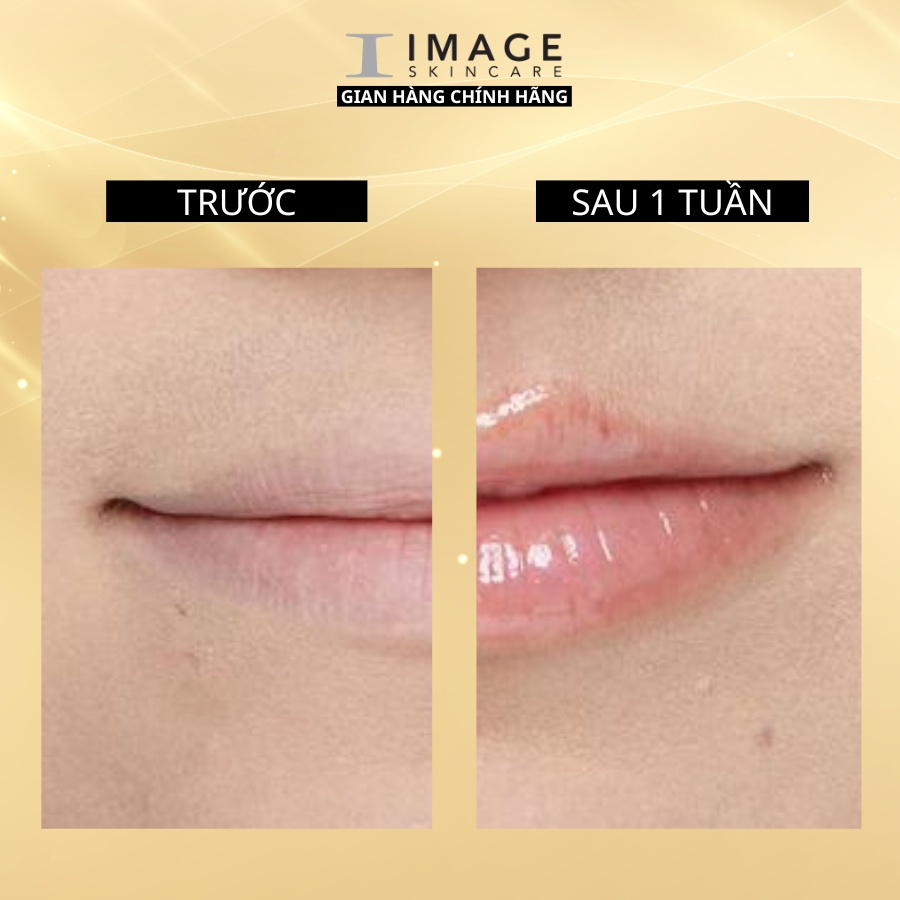 Son dưỡng môi chiết xuất tự nhiên Image Skincare Ormedic Lip Enhance Complex - Care For Skin 7g