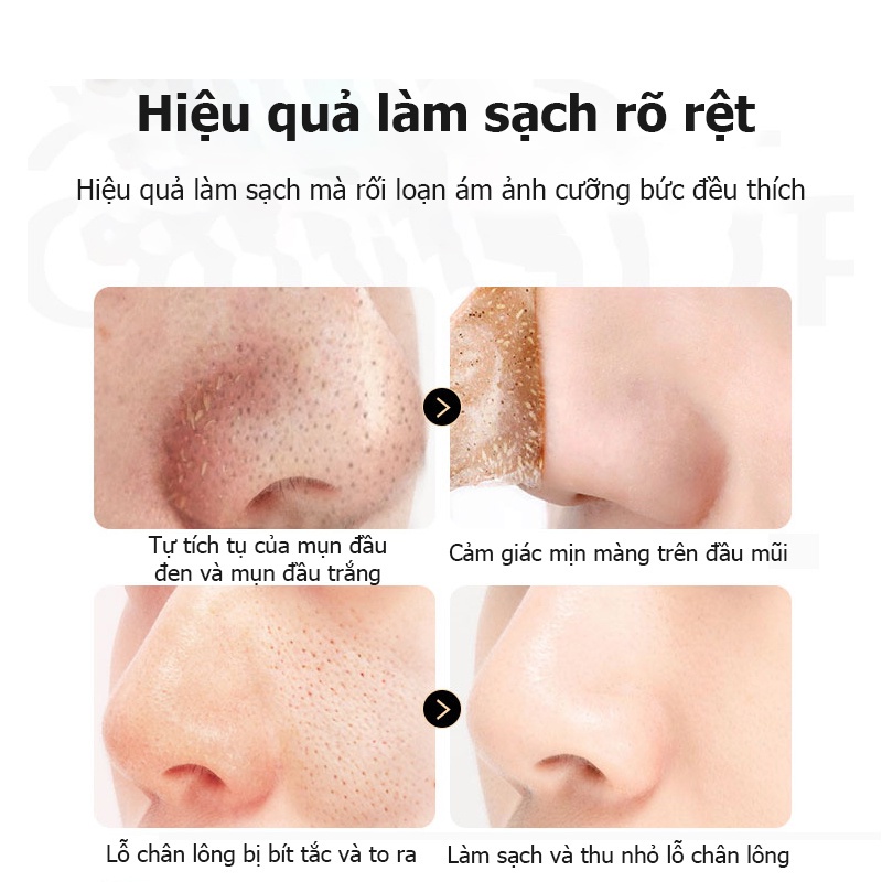 Mặt Nạ Lột Mụn Đầu Đen Làm Sạch Da Mặt 80g