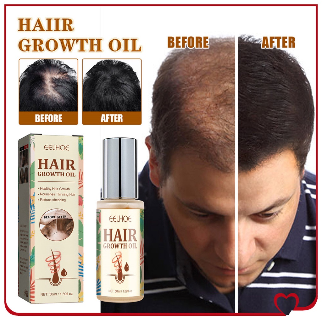 Eelhoe 50Ml Tinh Dầu Mọc Tóc Dưỡng Ẩm Chống Rụng Tóc Tinh Dầu Sản Phẩm Điều Trị Tóc Mỏng Frizzy Tăng Trưởng Nhanh Serum nam Nữ Chăm Sóc