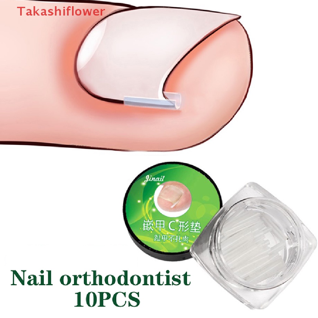 Set 10 Miếng Đệm Chỉnh Hình Móng Chân Chuyên Dụng