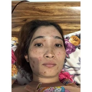 [Kem face tổ yến] combo 2 hộp kem