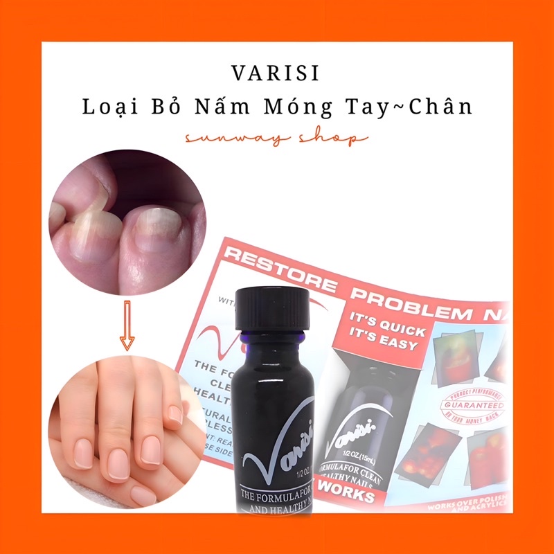 Varisi Loại Bỏ Nấm Móng Tay-Nấm Móng Chân
