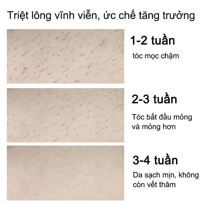 Kem tẩy lông Tẩy lông vùng kín Cho bà bầu 100g chóng không đau tẩy lông nách cả người tay chân toàn thân nam nữ toàn có