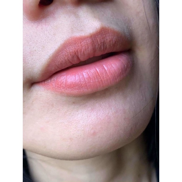 Combo siêu dưỡng môi và cấy hồng môi Collagen Thiên di giúp giảm thâm môi làm hồng môi kích màu sau phun xăm