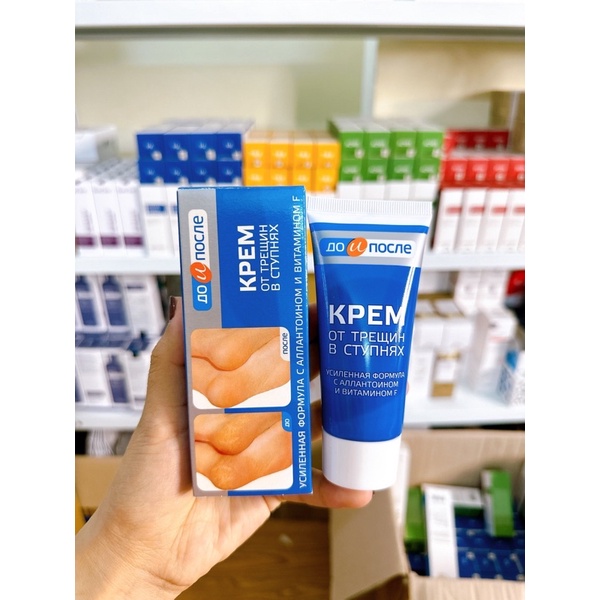 Kem bôi gót chân Kpem 50ml