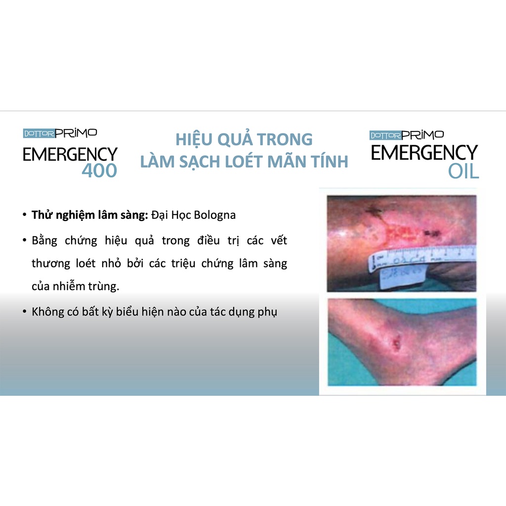 Dầu Xịt Vết Thương DottorPrimo Emergency Oil (Chai 30ml)