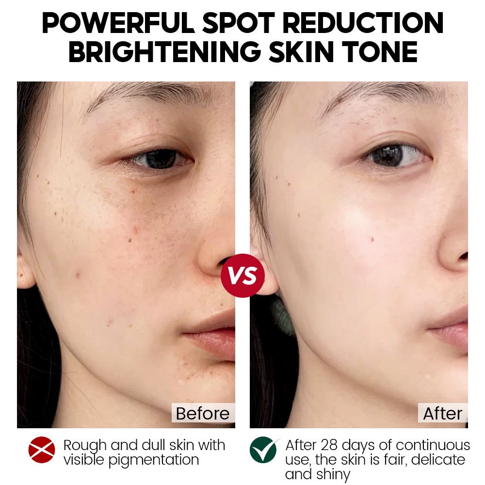 Set 5 Mặt Nạ VIBRANT GLAMOUR Arbutin Làm Trắng Da Tức Thì Cung Cấp Vitamin B5