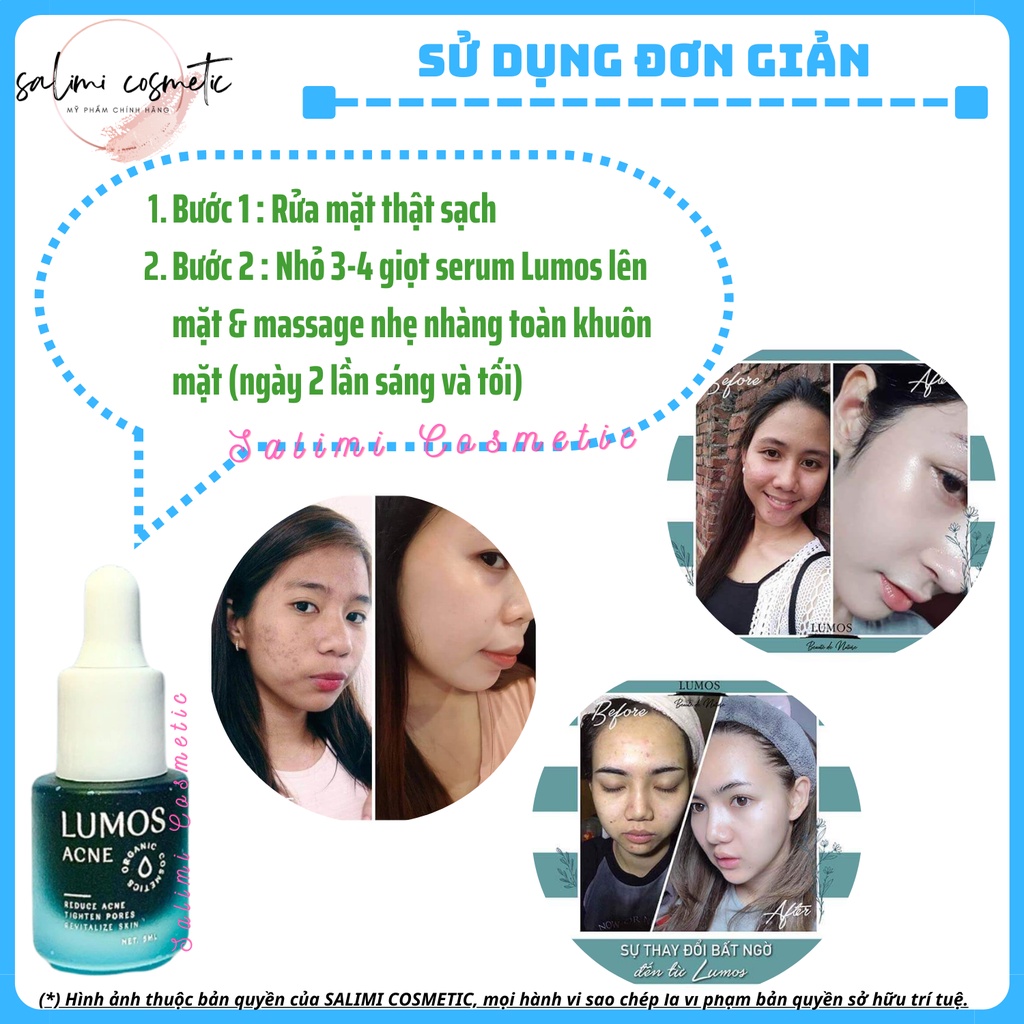 Serum Mụn LUMOS ACNE - Hỗ Trợ Trị Mụn, Làm Mờ Vết Thâm Mụn Để Lại, Đều Màu Da, Da Khoẻ Căng Bóng, Se Khít Lỗ Chân Lông