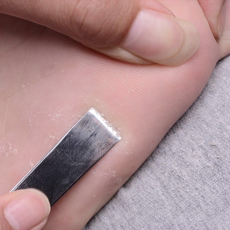 Dao lấy khoé cạo da chết 3 cây - Cây lấy khóe tay chân - PLN937