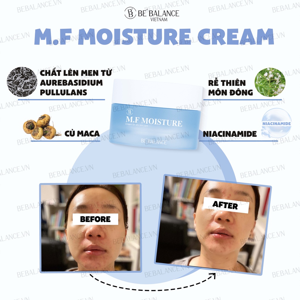 Kem dưỡng chuyên sâu cấp ẩm, phục hồi, bảo vệ da Be'Balance M.F Moisture Cream (150ml)