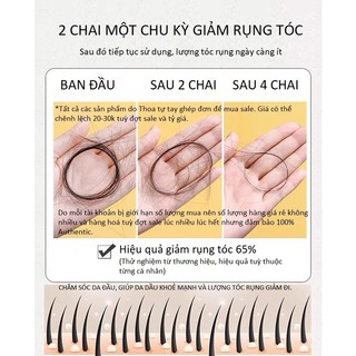 Dầu gội gừng KING GINGER MOFAJANG | Dầu gội gừng ngăn rụng tóc và kích thích mọc tóc