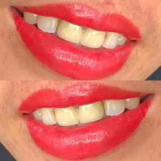 [ 5 Chai ] Dưỡng Môi Collagen Hàn Quốc 5ml