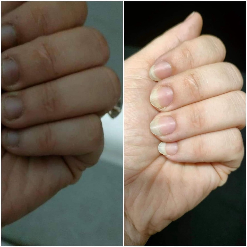 Dưỡng Móng Độc Quyền Thiên Di, Giúp Dài Móng, khoẻ, bóng,hồng