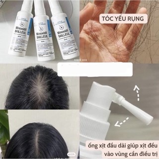 Xịt mọc tóc Minoxidil balleul 2%