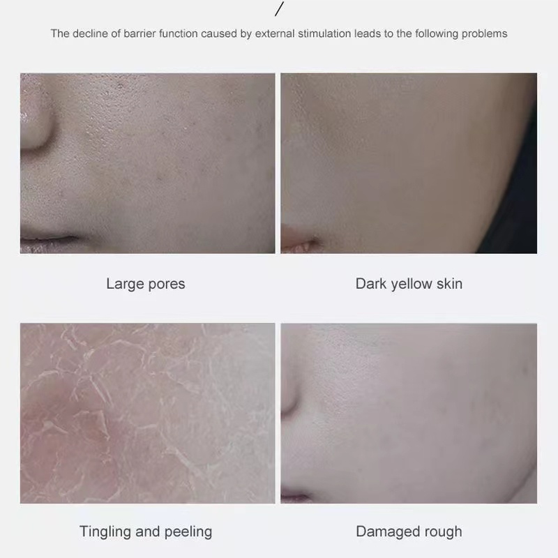 Bộ 6 Sản Phẩm Chăm Sóc Da Mặt Dưỡng Ẩm HIISEES Saccharomyces Bifidus