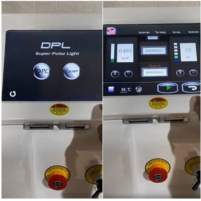 Máy triệt lông Hera, Máy triệt lông 2in1 laser xóa xăm xóa nám tàn nhang vĩnh viễn
