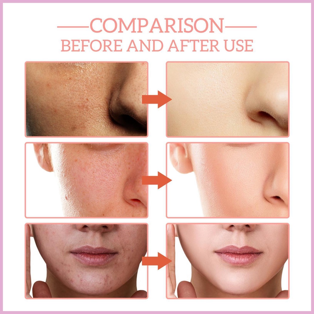 Tinh Chất Dưỡng Ẩm 30ml 5 Trong 1 Giúp Da Săn Chắc Và Sáng Bóng