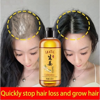 Image of Shampo anti rambut rontok Shampo penumbuh rambut Sampo jahe  300ML Hair treatment Merangsang pertumbuhan rambut