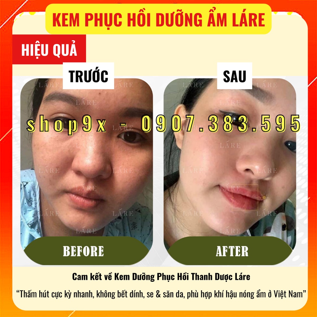 Kem Phục Hồi Dưỡng Ẩm Thanh Dược Láre