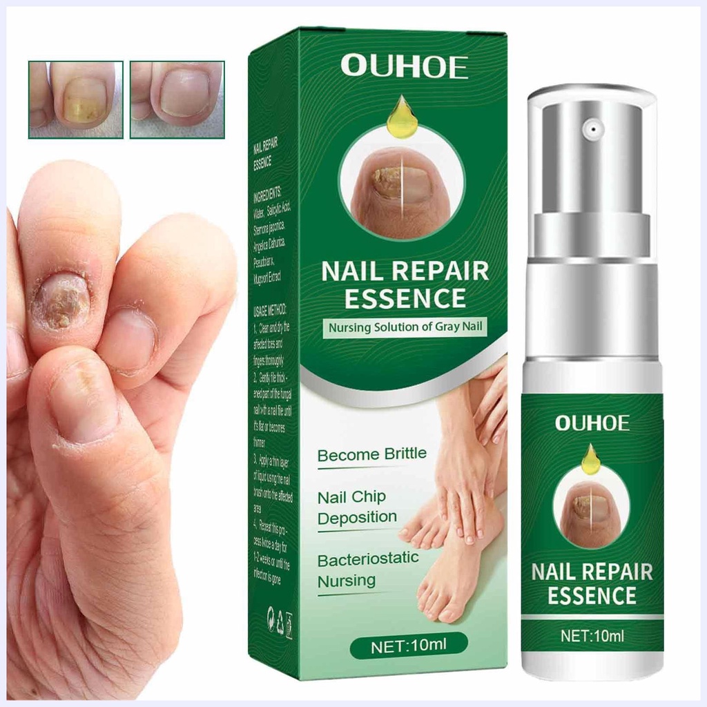 Tinh chất phục hồi chăm sóc móng hư tổn