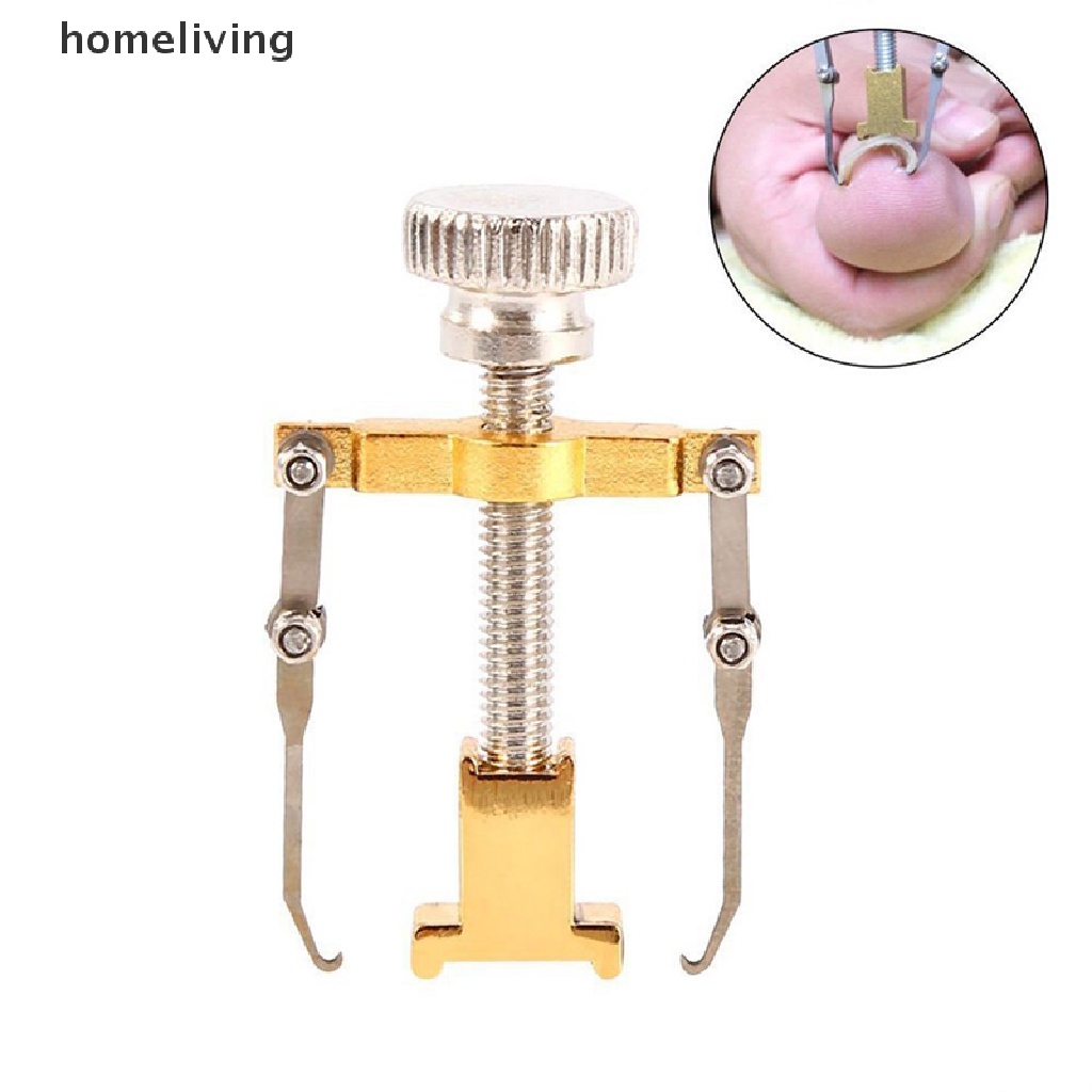 Dụng Cụ Kẹp Hỗ Trợ Chăm Sóc Móng Chân Tiện Lợi