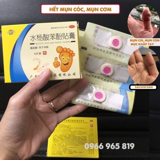 Miếng dán mụn cóc, mụn cơm hộp 6 miếng